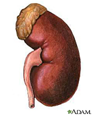 Is it just me, or does it look like this kidney is wearing a toupee.