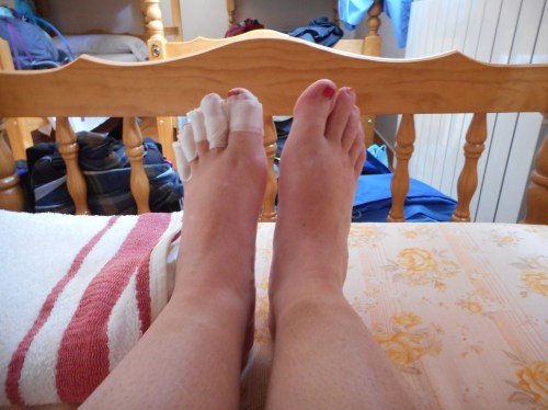 Mostly the left foot.